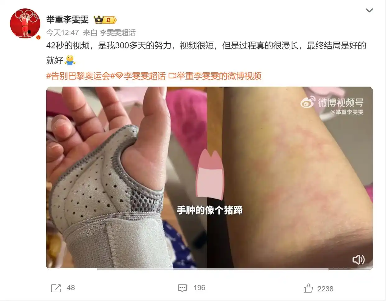 中国女举重冠军雯雯是哪里人_举重冠军女2021李雯雯_女子举重冠军李雯雯